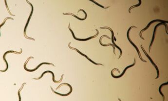 parasites living in the human body