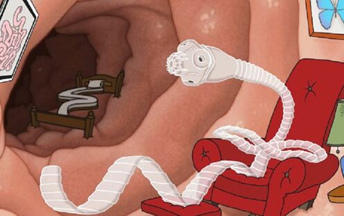 A parasite has settled in the intestine