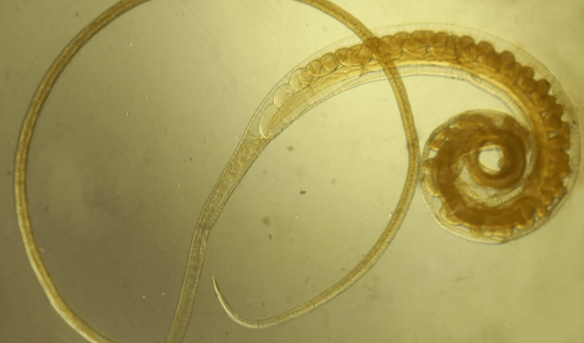 Trichocefalosis of Vlasov