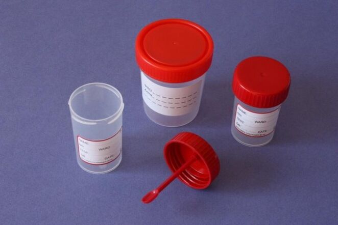 Parasite diagnostics methods in humans