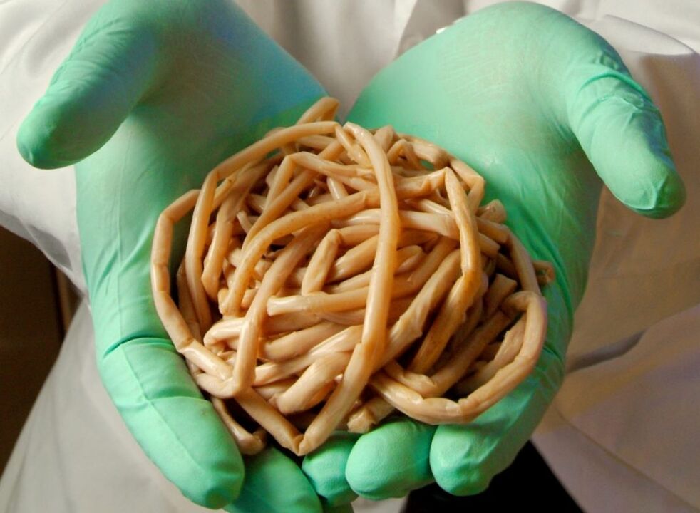 What parasites have humans